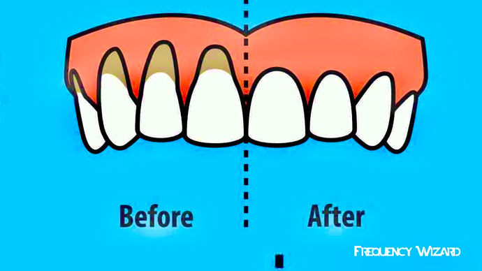 RECEDING GUMS TREATMENT! WORKS FAST! FIX GUM RECESSION SUBLIMINAL SUBCONSCIOUS HYPNOSIS BINAURAL BEATS SPELL - FREQUENCY WIZARD