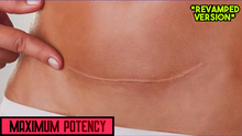 Load image into Gallery viewer, Remove Tummy Tuck Scar Fast! - Tummy Tuck Scar Removal (Revamped Version)