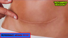 Load image into Gallery viewer, Remove Tummy Tuck Scar Fast! - Tummy Tuck Scar Removal (Revamped Version)