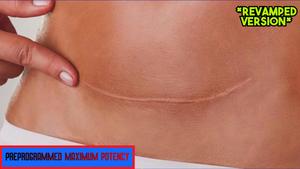 Remove Tummy Tuck Scar Fast! - Tummy Tuck Scar Removal (Revamped Version)