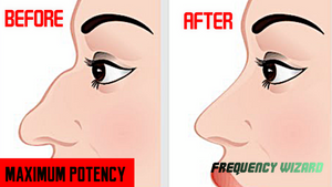GET RID OF BUMP ON NASAL BRIDGE OF NOSE FAST! - SUBLIMINAL FREQUENCY HYPNOSIS WIZARD