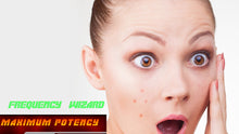 Load image into Gallery viewer, Get Rid of Acne, Pimples, Zits, Blemishes Fast! - Frequency Wizard