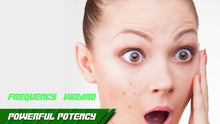 Load image into Gallery viewer, Get Rid of Acne, Pimples, Zits, Blemishes Fast! - Frequency Wizard