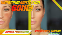 Load image into Gallery viewer, Hyperpigmentation Eliminator (Incredible Results!) Rapid Elimination!