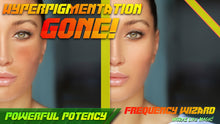 Load image into Gallery viewer, Hyperpigmentation Eliminator (Incredible Results!) Rapid Elimination!