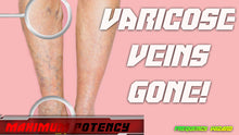 Load image into Gallery viewer, Get Rid of Varicose Veins Fast (Revamped)