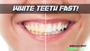 Get White Teeth Fast! (Revamped)