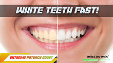 Load image into Gallery viewer, Get White Teeth Fast! (Revamped)