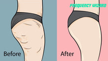 Load image into Gallery viewer, REMOVE STUBBORN CELLULITE FAST - FREQUENCY WIZARD